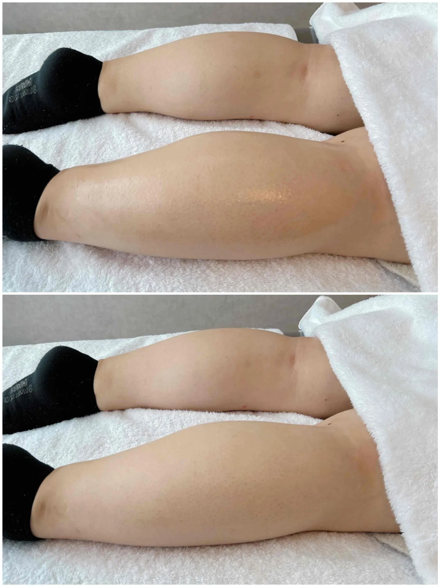 【施術例】足の健康をサポートいたします