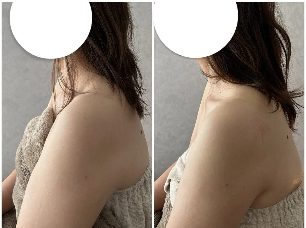 二の腕ほっそり!